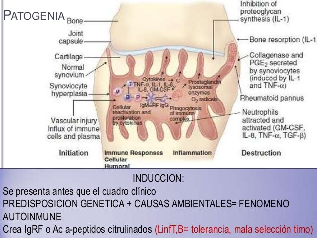 artritis reumatoide cuadro clinico radiologia artritis reumatoide artritis reumatoide cuadro clinico radiologia artritis reumatoide