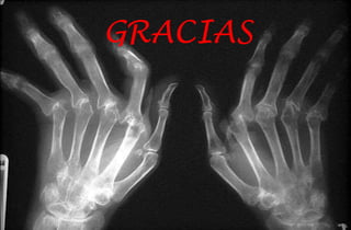 GRACIAS

 