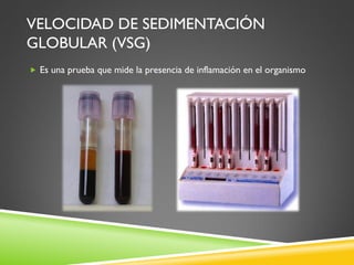 Vsg Lab Artritis reumatoide | PDF