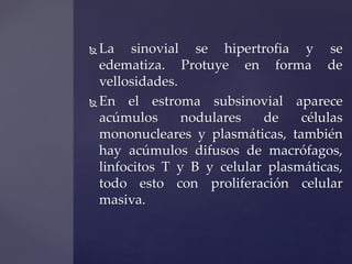 La sinovial se hipertrofia y se 
edematiza. Protuye en forma de 
vellosidades. 
En el estroma subsinovial aparece 
acúmu...
