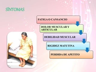 SÍNTOMAS
FATIGA O CANSANCIO
DOLOR MUSCULAR Y
ARTICULAR
DEBILIDAD MUSCULAR
RIGIDEZ MATUTINA
PERDIDA DE APETITO
 