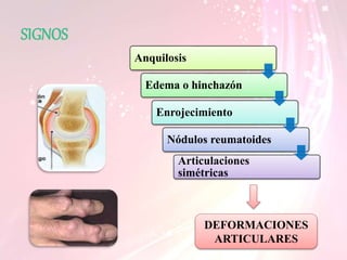 SIGNOS
Anquilosis
Edema o hinchazón
Enrojecimiento
Nódulos reumatoides
Articulaciones
simétricas
DEFORMACIONES
ARTICULARES
 