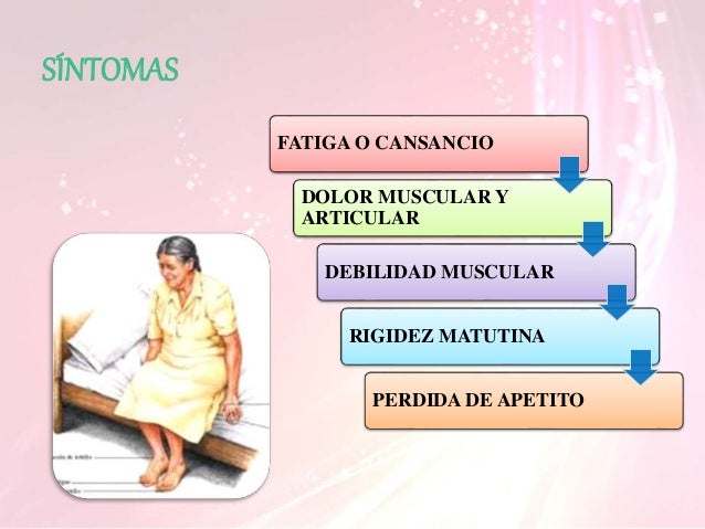 Rigidez muscular matutina
