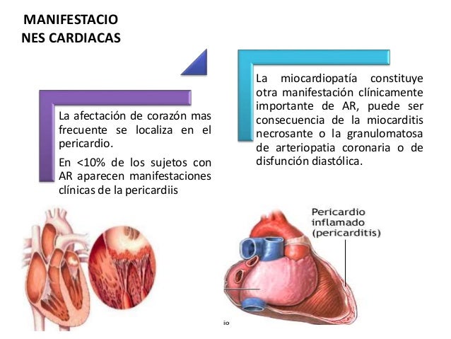 Disfuncion Diastolica Grado 1 Es Grave