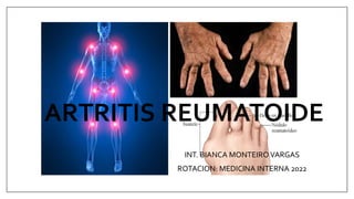 ARTRITIS REUMATOIDE
INT. BIANCA MONTEIRO VARGAS
ROTACION: MEDICINA INTERNA 2022
 