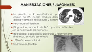 MANIFESTACIONES PULMONARES
 La pleuritis, es la manifestación pulmonar más
común de RA, puede producir dolor pleurítico y
disnea y también frote pleural y derrame (exudado).
 Neumopatía intersticial
 Diagnóstico por medio de TAC, opacidad infiltrativa
en la periferia de los pulmones.
 Radiografía: opacidades bilaterales y relativamente
simétricas, en vidrio esmerilado
 10% más de mortalidad
 Síndrome de Caplan
 