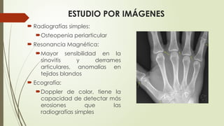 ESTUDIO POR IMÁGENES
 Radiografías simples:
Osteopenia periarticular
 Resonancia Magnética:
Mayor sensibilidad en la
sinovitis y derrames
articulares, anomalías en
tejidos blandos
 Ecografía:
Doppler de color, tiene la
capacidad de detectar más
erosiones que las
radiografías simples
 