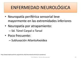 ENFERMEDAD NEUROLÓGICA
• Neuropatía periférica sensorial leve
mayormente en las extremidades inferiores
• Neuropatía por a...