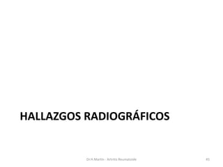 HALLAZGOS RADIOGRÁFICOS
Dr.H.Martín - Artritis Reumatoide 45
 
