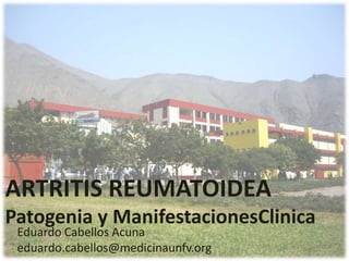 ARTRITIS REUMATOIDEA
Patogenia y ManifestacionesClinica
 Eduardo Cabellos Acuna
 eduardo.cabellos@medicinaunfv.org
 