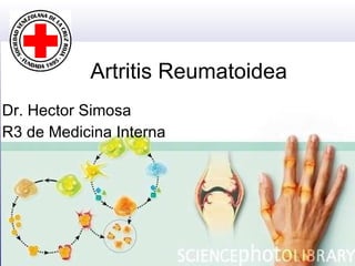 Artritis Reumatoidea Dr. Hector Simosa R3 de Medicina Interna 