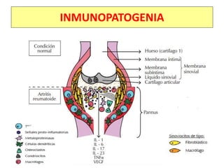 INMUNOPATOGENIA
 