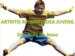 ARTRITIS REUMATOIDEA JUVENIL

      Dra. Zoila De Jesus
 