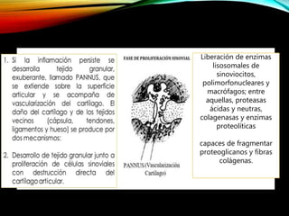 Liberación de enzimas
lisosomales de
sinoviocitos,
polimorfonucleares y
macrófagos; entre
aquellas, proteasas
ácidas y neutras,
colagenasas y enzimas
proteolíticas
capaces de fragmentar
proteoglicanos y fibras
colágenas.
 