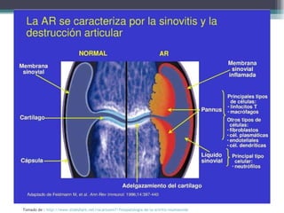 Tomado de :  http://www.slideshare.net/rocartoom7/fisiopatologia-de-la-artritis-reumatoide   
