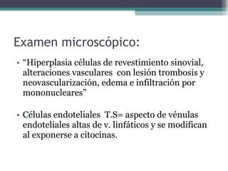 Examen microscópico: “ Hiperplasia células de revestimiento sinovial, alteraciones vasculares  con lesión trombosis y neovascularización, edema e infiltración por mononucleares” Células endoteliales  T.S= aspecto de vénulas endoteliales altas de v. linfáticos y se modifican al exponerse a citocinas. 