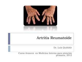 Artritis Reumatoide
Dr. Luis Quiñiñir
Curso Avances en Medicina Interna para atención
primaria, 2012
 