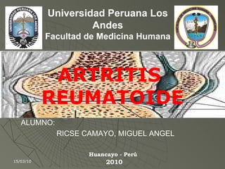 15/03/10 Huancayo - Perú   2010 Universidad Peruana Los Andes Facultad de Medicina Humana ALUMNO:  RICSE CAMAYO, MIGUEL ANGEL ARTRITIS  REUMATOIDE 