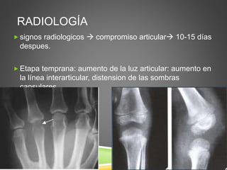 RADIOLOGÍA 
 signos radiologicos  compromiso articular 10-15 días 
despues. 
 Etapa temprana: aumento de la luz articular: aumento en 
la línea interarticular, distension de las sombras 
capsulares. 
 