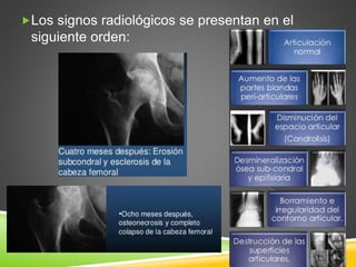 Los signos radiológicos se presentan en el 
siguiente orden: 
 
