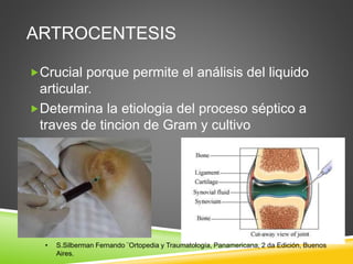 ARTROCENTESIS 
Crucial porque permite el análisis del liquido 
articular. 
Determina la etiologia del proceso séptico a 
traves de tincion de Gram y cultivo 
• S.Silberman Fernando ¨Ortopedia y Traumatología, Panamericana, 2 da Edición, Buenos 
Aires. 
 