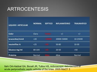 ARTROCENTESIS 
Ilahi OA-Habbal GA, Bocell JR, Tullos HS, Arthroscopic debridement of 
acute periprosthetic septic arthritis of the knee, 2005 Mar21 3 
 