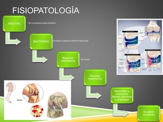 FISIOPATOLOGÍA 
SINOVIAL • Sin membrana basal limitante 
BACTERIAS • Acceden al espacio articular facilmente 
Reaccion 
inflamatoria 
• En horas 
Sinovitis 
hipertrofica 
Neutrofilos y 
monocitos 
liberan citocinas 
y proteasas 
Exudado 
purulento 
 
