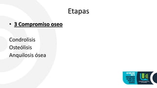 Artritis septica | PPTX