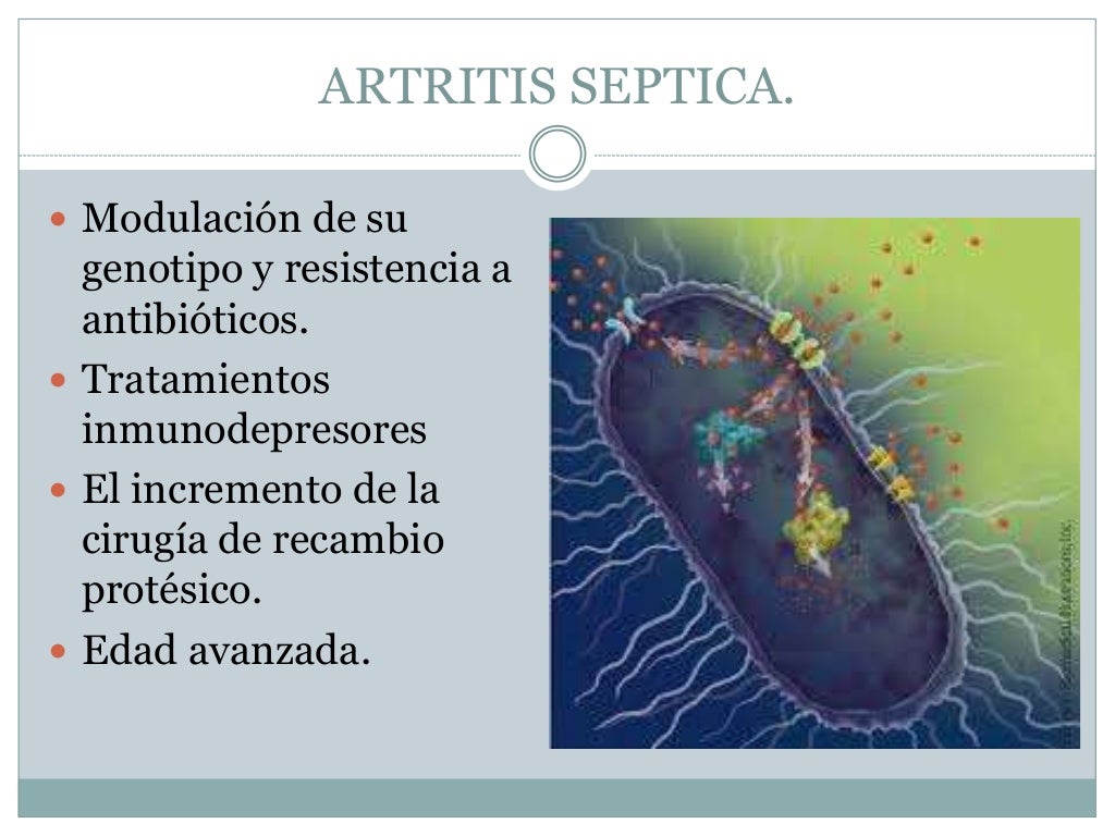 Artritis septica (2)