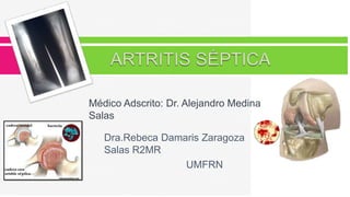 Médico Adscrito: Dr. Alejandro Medina
Salas
Dra.Rebeca Damaris Zaragoza
Salas R2MR
UMFRN
 
