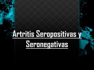 Artritis Seropositivas y
Seronegativas
 