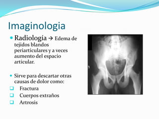 Inoculación de S. Aureus en animales:Enzimas proteolíticas primeras 24 horas.Liberación de glicosaminoglicanos y 3º-5º día daño del cartílago.Destrucción completa  5 semanas.Influenciados por la virulencia del gérmen, defensa del huesped y precodiad del inicio del tratamiento adecuado.