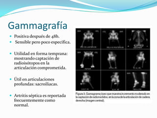   Llanto al movimiento