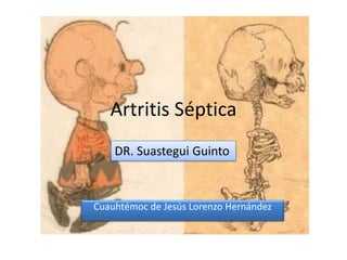 Artritis Séptica  DR. SuasteguiGuinto Cuauhtémoc de Jesús Lorenzo Hernández 