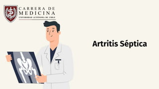 Artritis Séptica
 