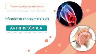 Infecciones en traumatología
Traumatología y ortopedia
ARTRITIS SÉPTICA
 