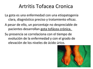 Artritis Tofacea Cronica  ,[object Object],[object Object],[object Object]
