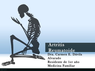 Artritis
Reumatoide
Dra. Carmen E. Dávila
Alvarado
Residente de 1er año
Medicina Familiar
 