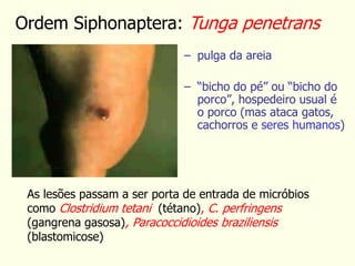 Ordem Siphonaptera: Tunga penetrans
– pulga da areia
– “bicho do pé” ou “bicho do
porco”, hospedeiro usual é
o porco (mas ataca gatos,
cachorros e seres humanos)
As lesões passam a ser porta de entrada de micróbios
como Clostridium tetani (tétano), C. perfringens
(gangrena gasosa), Paracoccidioides braziliensis
(blastomicose)
 