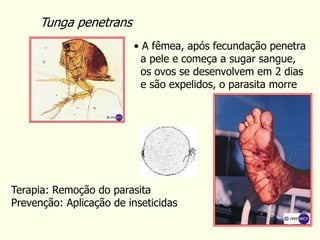 Tunga penetrans
• A fêmea, após fecundação penetra
a pele e começa a sugar sangue,
os ovos se desenvolvem em 2 dias
e são expelidos, o parasita morre
Terapia: Remoção do parasita
Prevenção: Aplicação de inseticidas
 