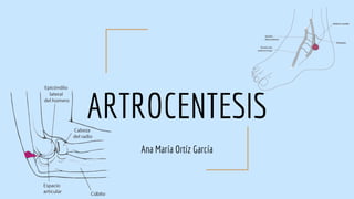 ARTROCENTESIS
Ana María Ortíz García
 