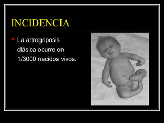INCIDENCIA
 La artrogriposis
clásica ocurre en
1/3000 nacidos vivos.
 