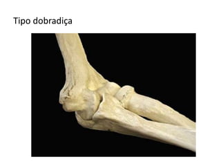 Tipo dobradiça