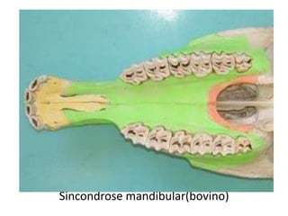 Sincondroses pós-cranianas:- Epifisiodiafisárias;- Epifisiocorporal;- Intra-epifisária;- Múltipla;- Esternais;- Manúbrio-esternal;- Xifoesternal;- Sacrais.