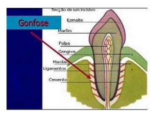 Sincondrose mandibular(bovino)
