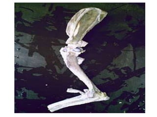 GONFOSES Também chamada de articulação em cavilha, é uma articulação fibrosa especializada restrita à fixação dos dentes nas cavidades alveolares na mandíbula e maxilas. 