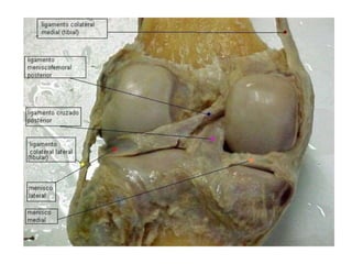 SUTURASNas suturas Este tipo de articulação é encontrado somente entre os ossos planos do crânio. Na maturidade, as fibras da sutura começam a ser substituídas completamente, os de ambos os lados da sutura tornam-se firmemente unidos, fundidos.Esta condição é chamada de sinostose.