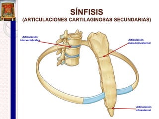 Sindesmosis
 Es una articulación fibrosa en la que los huesos se unen
mediante una lámina de tejido fibroso , ya sea ligamento o
una membrana fibrosa.
 Son parcialmente móviles (anfiartrosis).
 Ejemplos:
 Membrana interósea de las articulación radioulnar medial.
 Membrana interósea de la articulación tibiofibular media.
 Articulación tibiofibular inferior o distal.
 Ligamento sacroilíaco posterior.
 Ligamentos interespinales que unen un proceso espinoso de una
vértebra con el inmediato.
 