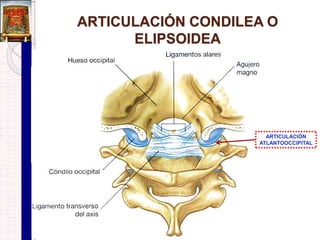 Otros componentes de una articulación
sinovial
 Menisco articular:
 2 estructuras de forma semilunar formadas de fibrocartílago.
 Al corte y vista de perfil recuerdan una cuña, 2 de sus caras miran a
la superficie articular y su base periférica se adhiere a la cápsula.
 Divide a la articulación en 2 cavidades secundarias.
 Puede observarse una perforación en su centro.
 Ej. meniscos medial y lateral de la articulación de la rodilla.
 