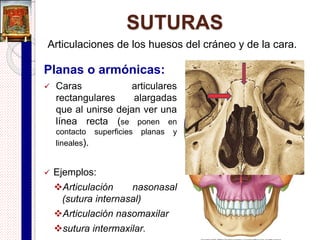 Suturas
 